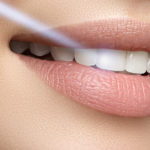 矯正歯科はなぜ必要なのか