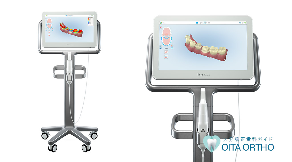 3D診断 iTero Elementとは