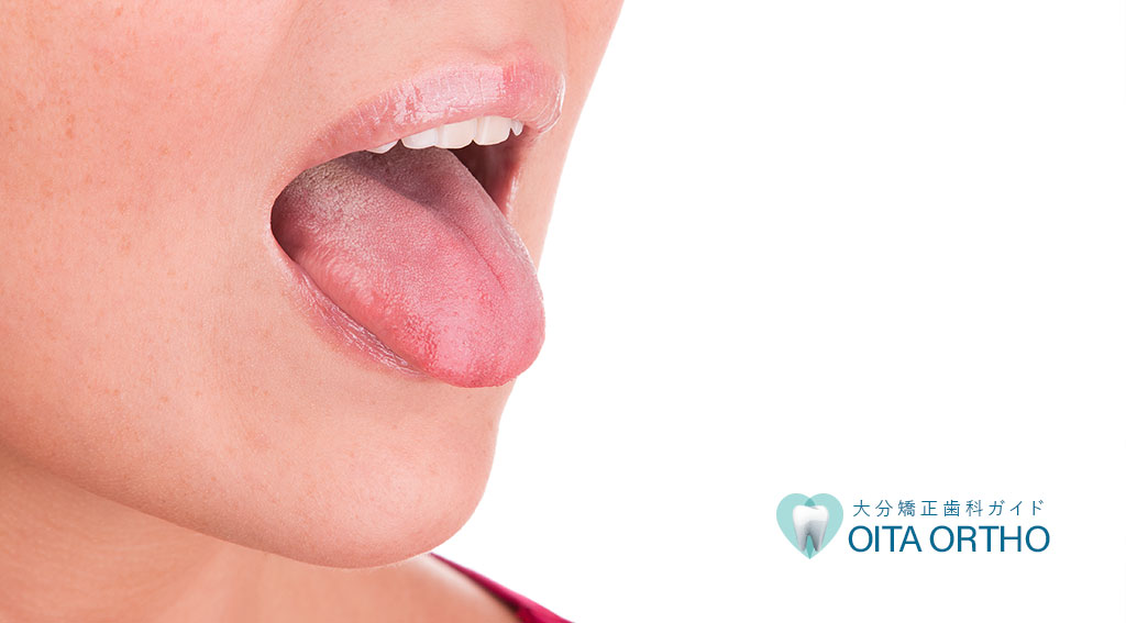 舌小帯短縮症とは