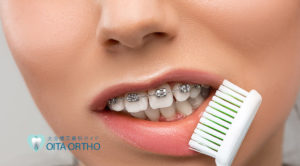 矯正器具のメンテナンスはどうやるの?