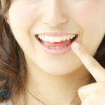 チャームポイントにもなる「八重歯」は実は不正咬合の一種