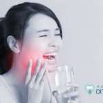 歯が溶ける? 酸蝕歯に気をつけよう