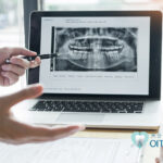 外科処置が必要な「外科矯正」とは